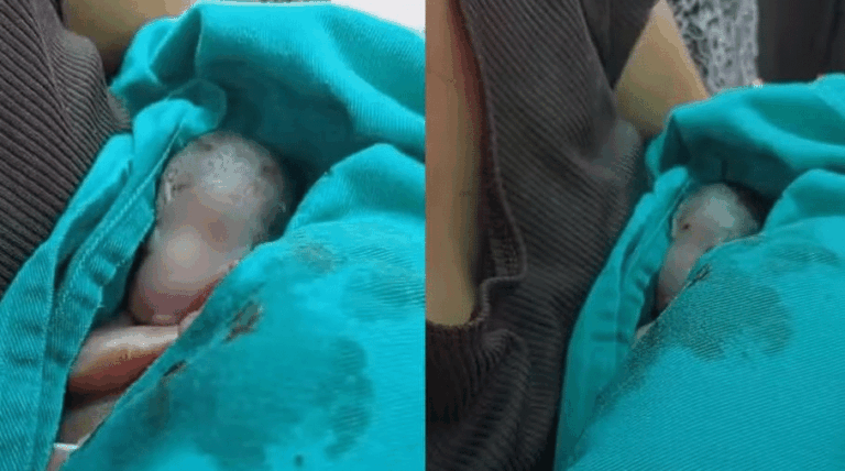 bebe-prematuro-dado-como-morto-e-retirado-do-proprio-velorio-com-vida-no-acre-apos-familia-ouvir-choro